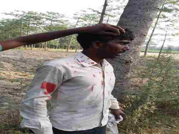 Six injured when lepard attacked in Sitapur