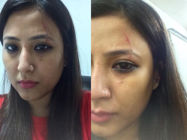 महिला ने पत्रकार का फोन छीन लिया 