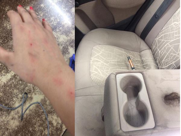 ऊबर का पूरा बैक सीट मेरे बालों से भरा पड़ा है