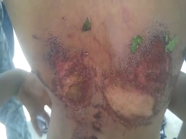 10 year old kid beaten by his step mother and father, video