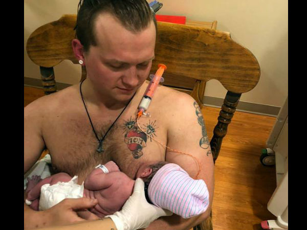 सप्लीमेंटल नर्सिंग मेथड से करवाया स्तनपान सप्लीमेंटल नर्सिंग मेथड से करवाया स्तनपान