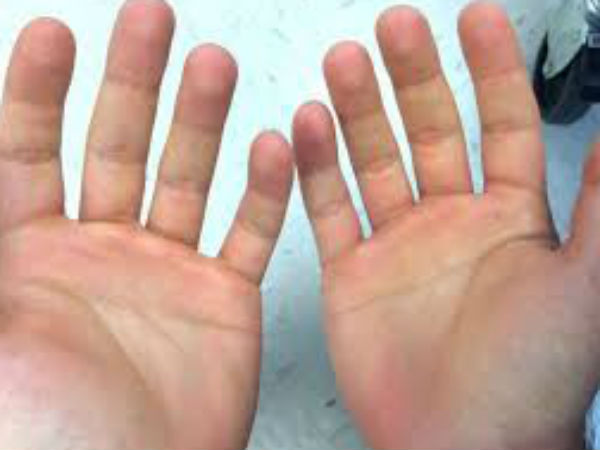 सूर्य रेखा से चमकती है किस्मत 