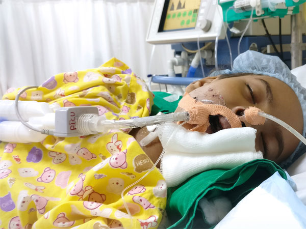 girl, Vishaka, girl Fighting Multiple Organ Failure