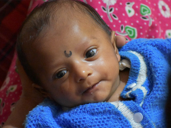 baby, save a life, treatment, help, surgery, doctor baby, save a life, treatment, help, surgery, doctor