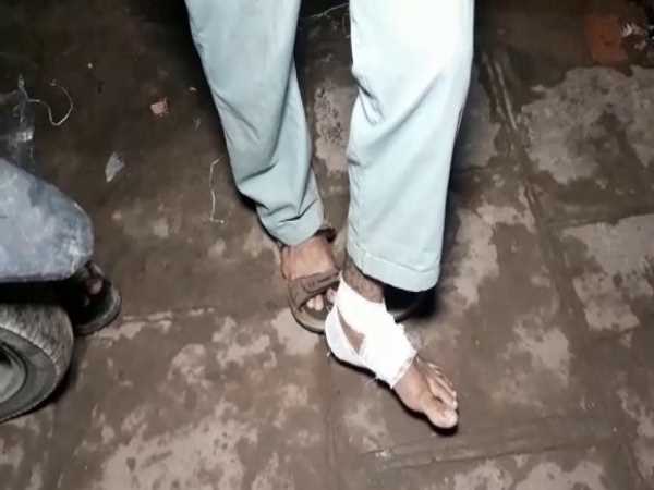 donkey killed for biting people in varanasi