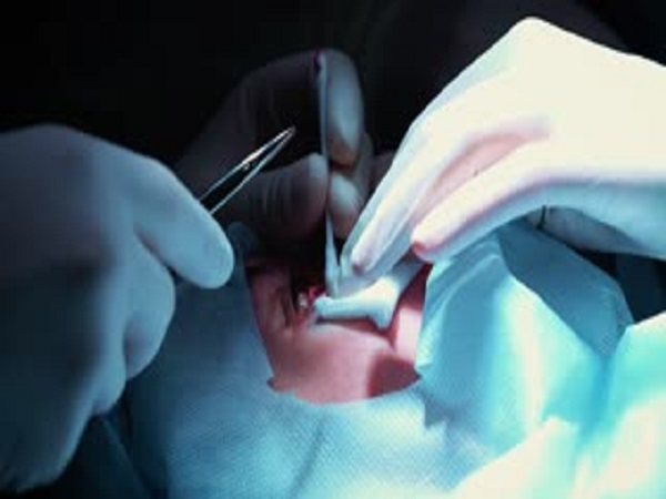 आंखों के ऑपरेशन में लापरवाही आंखों के ऑपरेशन में लापरवाही