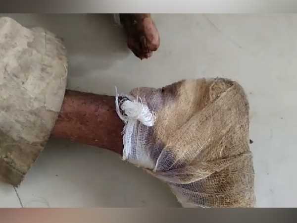 Patient lying on the floor of the hospital for three days 