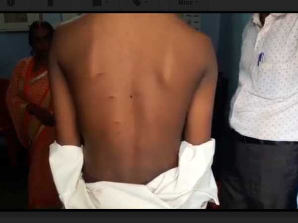 teacher beat student brutally with his belt for not coming to school teacher beat student brutally with his belt for not coming to school