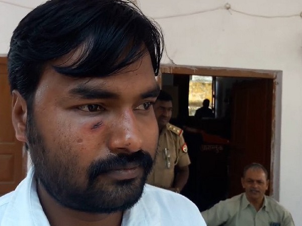 चार कर्मी घायल हुए 