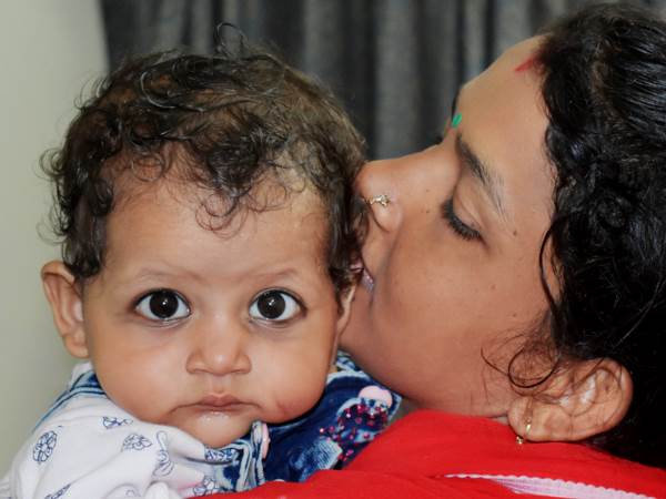 11 महीने की शिवानी की सर्जरी के लिए नहीं है मां-बाप के पास पैसे