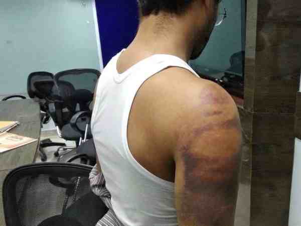 पुलिस में की शिकायत