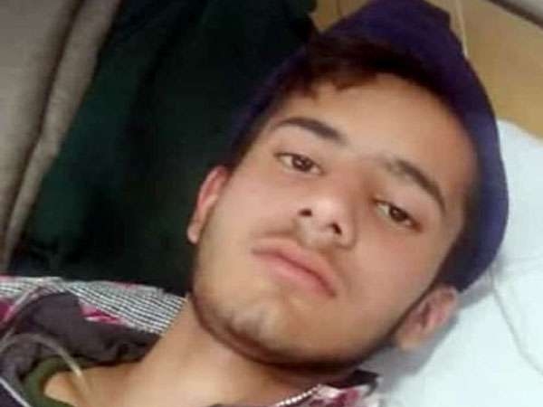 डॉक्‍टर्स ने बताई थी सिर में रसौली, इलाज के लिए ले जाया गया तीन अस्‍पताल 