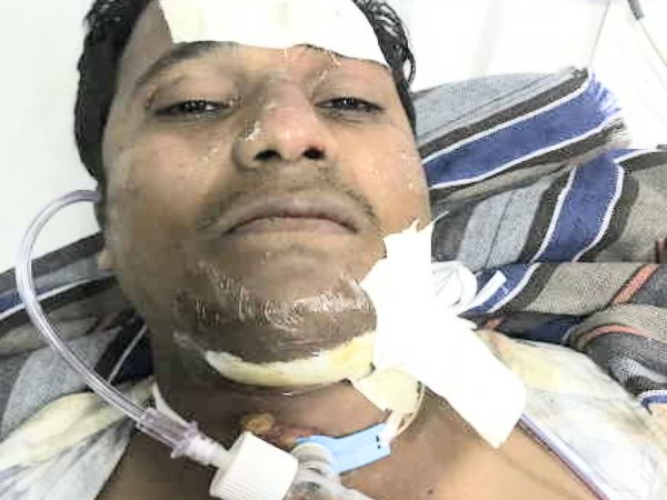 ग्रिल उसकी ठुड्डी में घुस गई