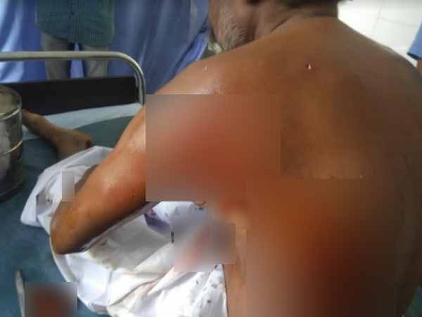 PHOTOS: lion attack on man in village of rajkot 