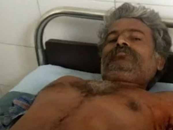 PHOTOS: lion attack on man in village of rajkot 