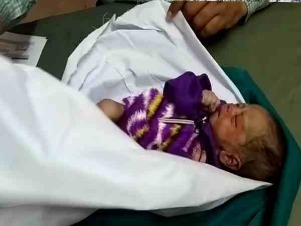 कुत्तों ने शिशु को नोचा