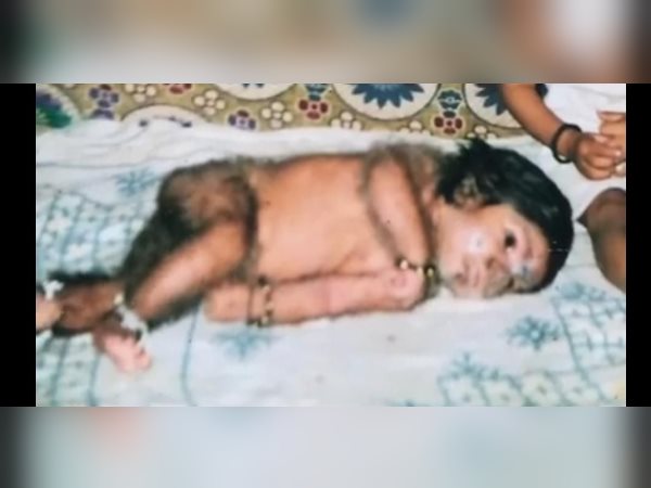 विदेशी डॉक्टरों की मदद से करवाएंगे इलाज विदेशी डॉक्टरों की मदद से करवाएंगे इलाज