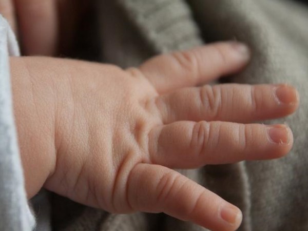 24 हफ्ते के अजन्मे बच्चे में मिली थी रीढ़ की समस्या