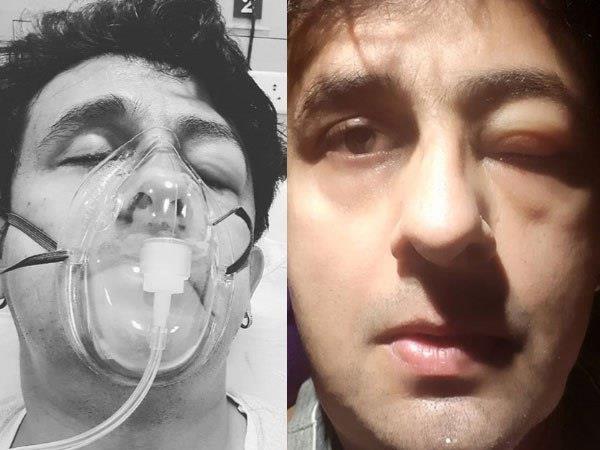 कैसे हुई सोनू की ये हालत