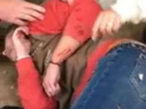 महिला को आई काफी चोट