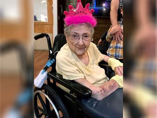 रोज मेरी के अधिकांश अंग गलत जगह पर थे