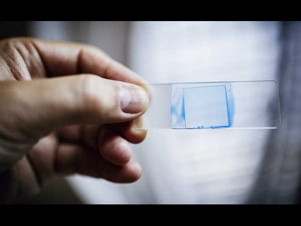 क्‍या नाम है संक्रमण फैलाने वाले इस जीवाणु का