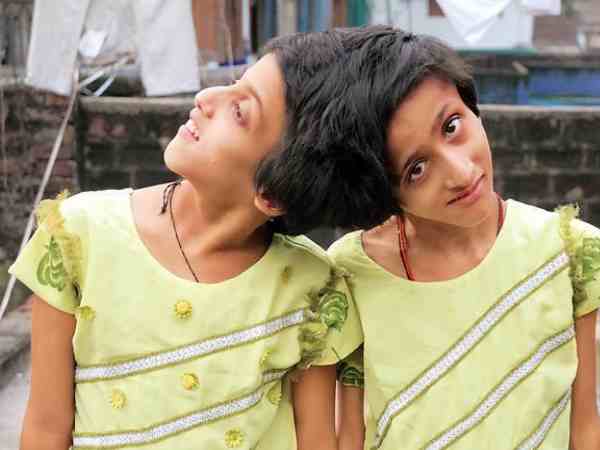 सिर से जुड़ीं हैं सबा और फराह