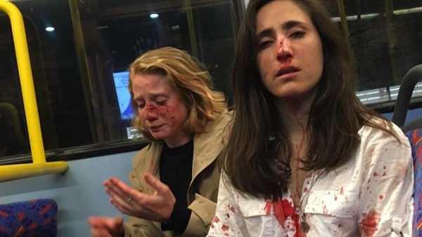 मनोरंजन के लिए उन्हें एक दूसरे को kiss (चूमने) के लिए कहा मनोरंजन के लिए उन्हें एक दूसरे को kiss (चूमने) के लिए कहा