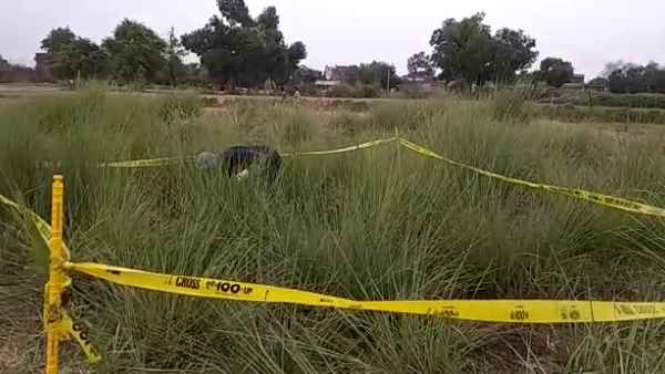 चेहरे पर रह गई थी हड्डी