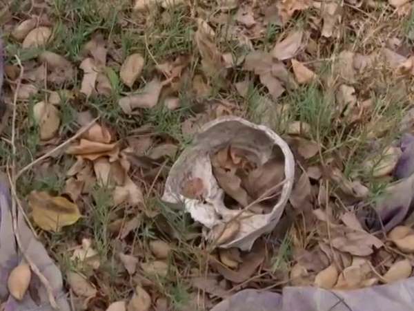 चमकी बुखार से बच्चों की मौत के बाद फिर विवादों में मुजफ्फरपुर का SKMCH