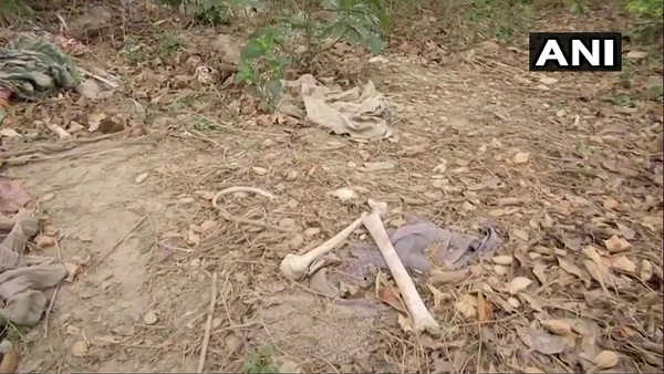 उसी अस्पताल के पीछे मिले नरकंकाल, जहां बच्चे तोड़ रहे हैं दम