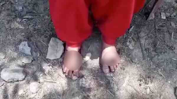 after meeting with boyfriend, father beats her brutally