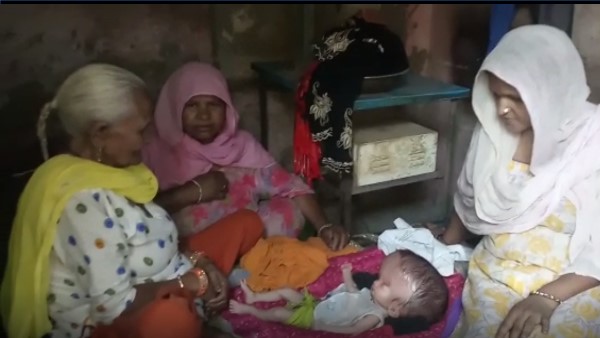 Bizarre child born in Dausa Rajasthan, weirdly growing head after birth