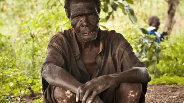 सरकार ने करना चाहा बीमारी का इलाज लेकिन...