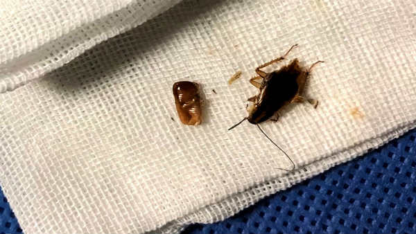 जब नाक और कान से निकले कॉकरोच के टुकड़े 