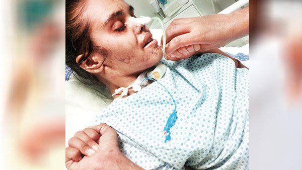 मुआवजे की रकम इतनी कैसे पहुंच गई?