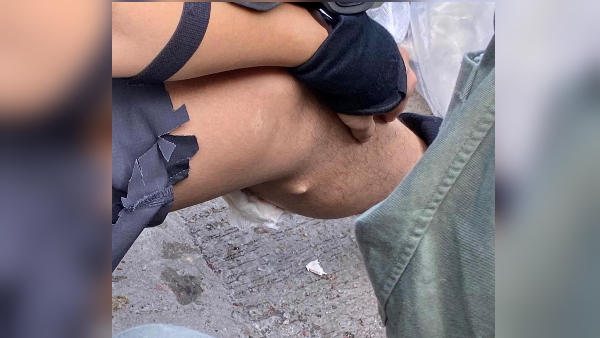 आंसू गैस का जवाब तीर-कमान से दे रहे छात्र आंसू गैस का जवाब तीर-कमान से दे रहे छात्र