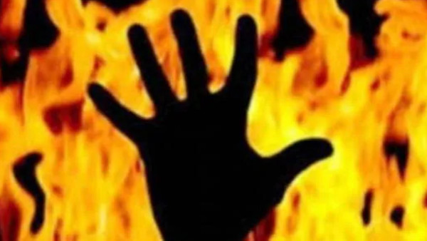 रेप पीड़िता को जिंदा जलाने का प्रयास 