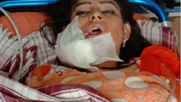 हिना का जख्म शायद भर न पाए: डॉक्टर हिना का जख्म शायद भर न पाए: डॉक्टर