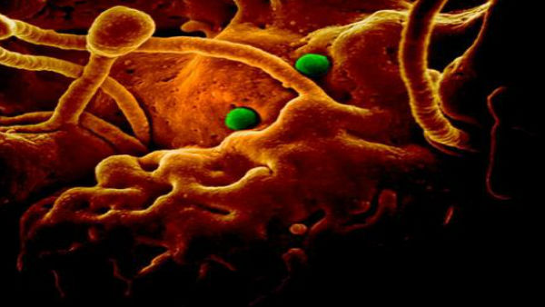  जानें कैसे फैलता है ये Brucellosis बैक्टीरिया