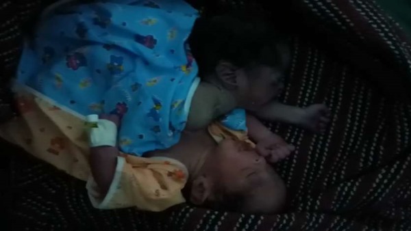  एम्स जोधपुर में रैफर