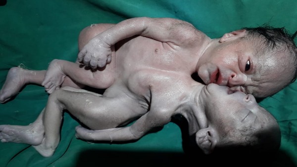 गांव मालनू की है प्रसूता