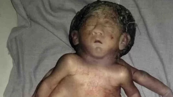 प्रसव पीड़ा के बाद महिला को किया भर्ती