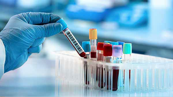  टेस्ट रिपोर्ट देख उड़े डॉक्टरों के होश