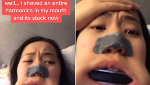 माउथ ऑर्गन मुंह में काफी देर तक फंसा रहा