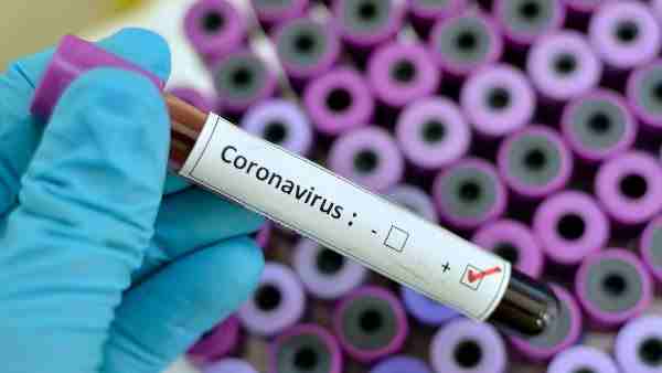 World Health Organization said COVID19 can be characterized as a pandemic World Health Organization said COVID19 can be characterized as a pandemic