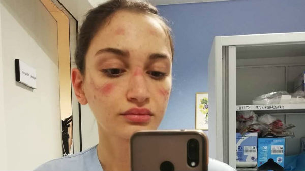 24 घंटे तक काम कर रहे डॉक्‍टर, नर्स 