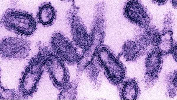 1920 में स्पैनिश फ्लू फैला, महामारी में गई 5 करोड़ की जान 