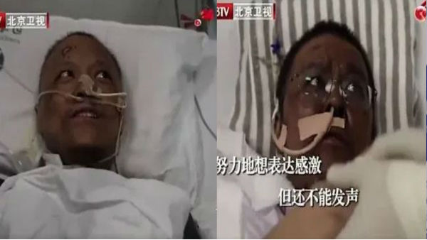  कोरोना के साइड इफेक्ट