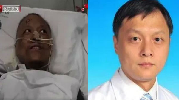 काला हो गया रंग